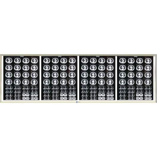 НПК Негатоскоп.Ру четырехкадровый LED (светодиодный) негатоскоп<span> (Россия)</span> — МедиМакс