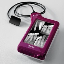 MyRay X-pod - беспроводная цифровая радиовизиографическая система size 2 (26x34mm)<span> (Италия)</span>